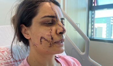 Marmaray İstasyonu’nda saldırıya uğradı! Yüzüne 40 dikiş atılan kadın o anları anlattı